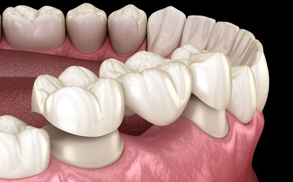 protetika-novi-beograd