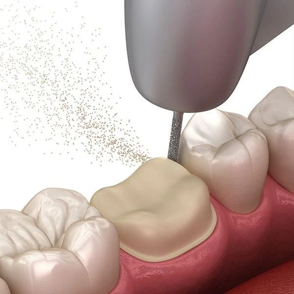 protetika-stomatologija