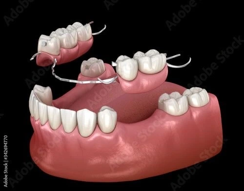 stomatoloska-protetika